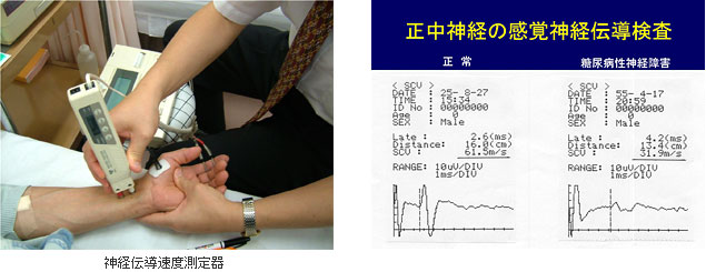 写真：神経伝達速度測定器で神経障害の検査をしている様子