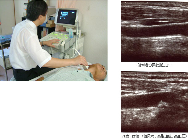 写真：超音波診断装置で頸動脈の検査をしている様子
